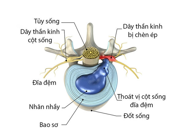 máy massage lưng