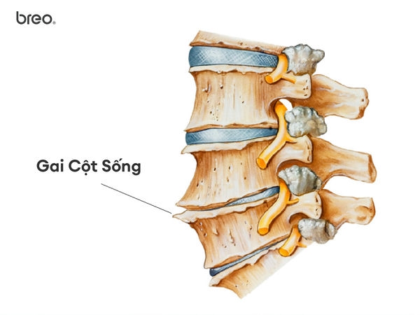 súng massage 